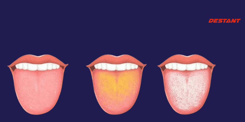 What Your Tongue Indicates About Your Health