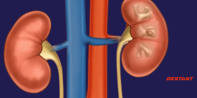 Kidney Removal Surgery – Dude Wheres My Kidney Tapestry