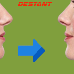 How To Get Rid of Neck Fat Under Chin Fast