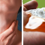 6 natural ways to get rid of phlegm with immediate results