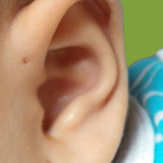 If You Have A Tiny Hole Above Your Ear, Here’s What It Means