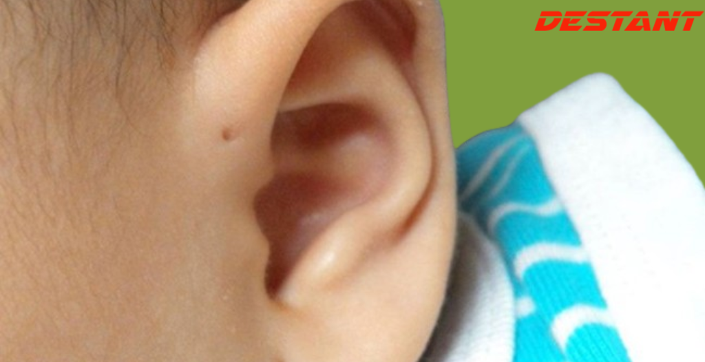 If You Have A Tiny Hole Above Your Ear, Here’s What It Means
