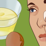 16 Home Remedies To Get Rid Of Eye Bags