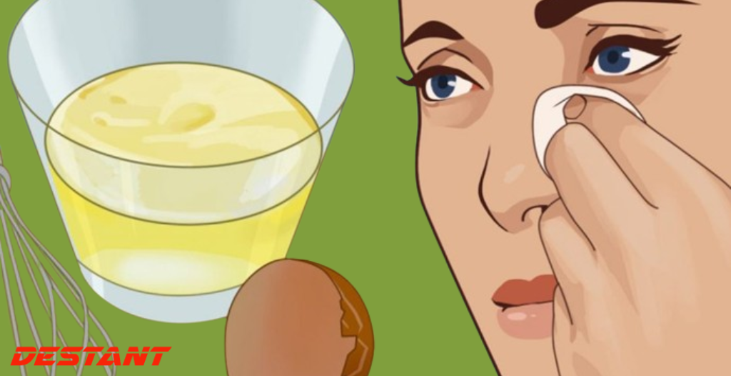 16 Home Remedies To Get Rid Of Eye Bags