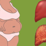 6 signs that your liver is full of toxins