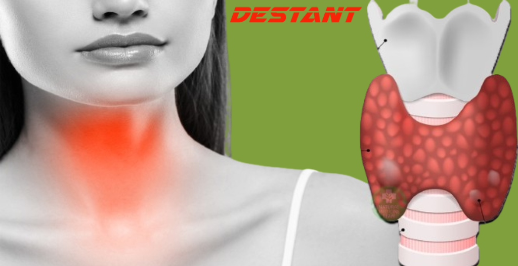 How to treat thyroid naturally