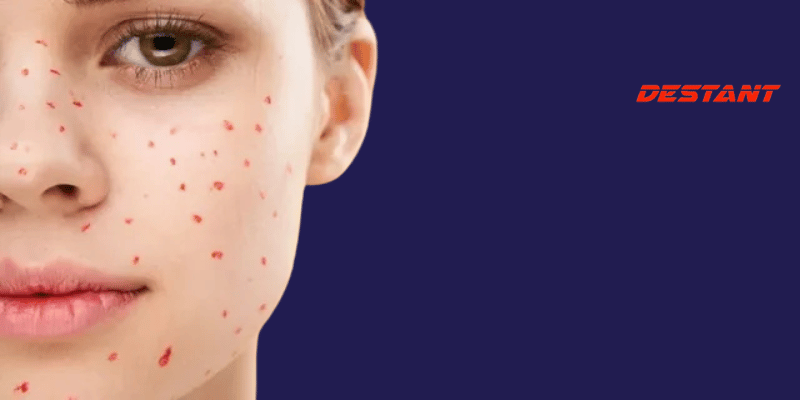 What Do These Red Dots On Your Skin Mean?