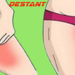 How do I get rid of the darkening of the buttocks and between the thighs and eliminate unpleasant discomfort?