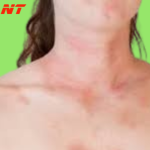 What Do These Red Dots On Your Skin Mean?