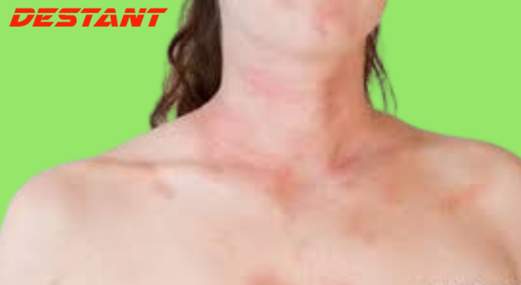 What Do These Red Dots On Your Skin Mean?